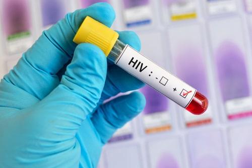 Illinois Social Security Disability Attorney for HIV